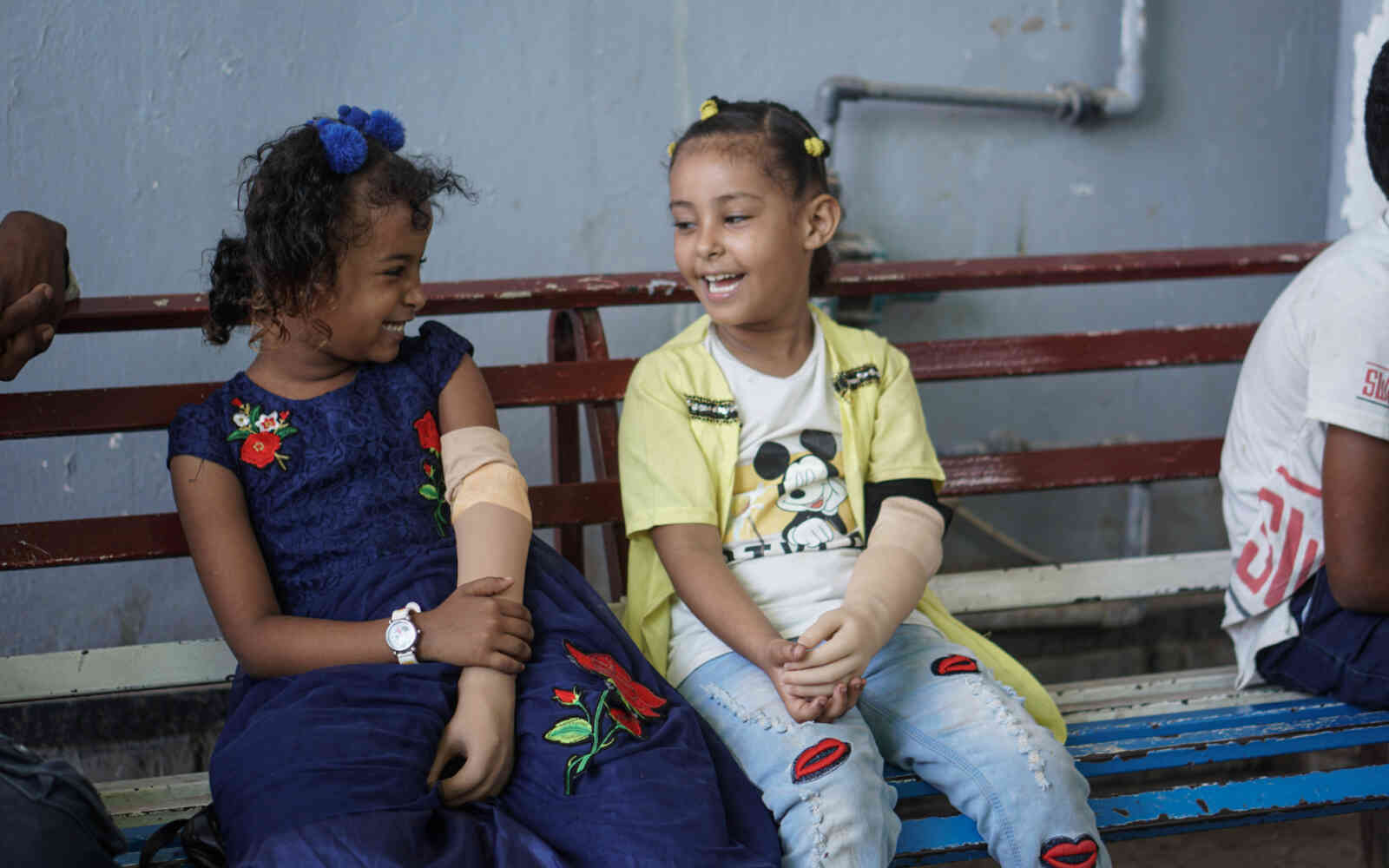 Malk, 7, and Abrar, 7, in the prosthetics centre in Aden, Yemen on 14 October 2021. Both children have a congenital disability and are receiving treatment in the centre.