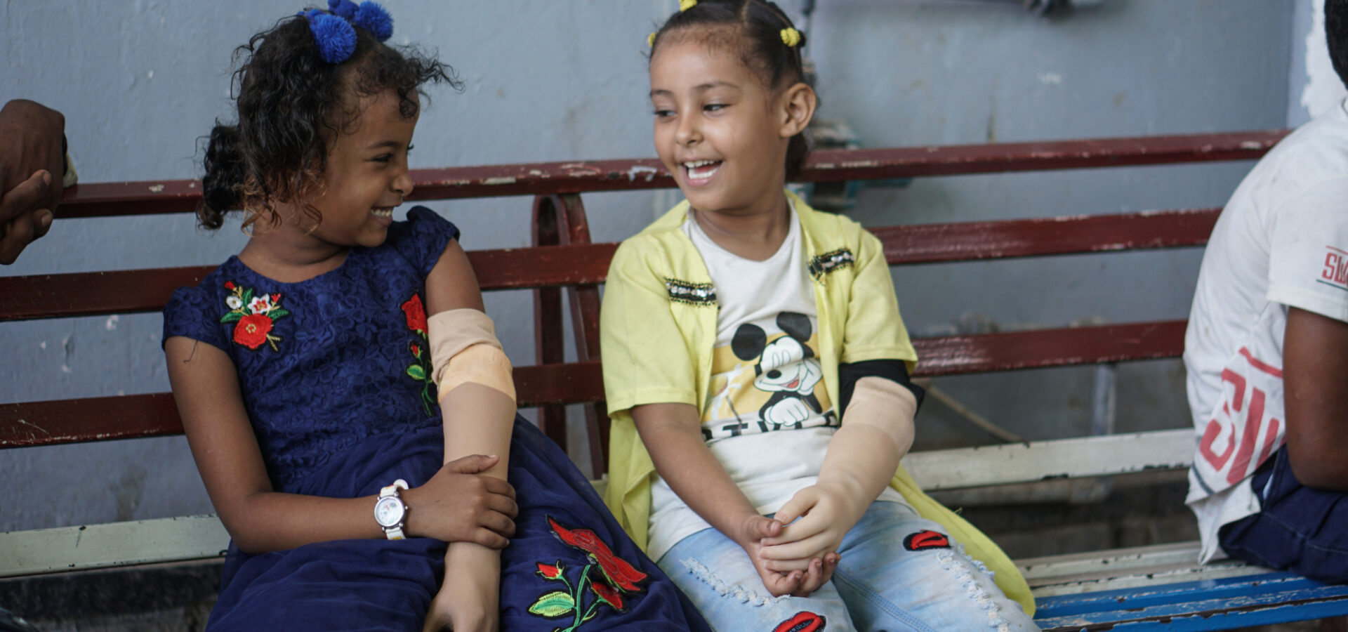 Malk, 7, and Abrar, 7, in the prosthetics centre in Aden, Yemen on 14 October 2021. Both children have a congenital disability and are receiving treatment in the centre.