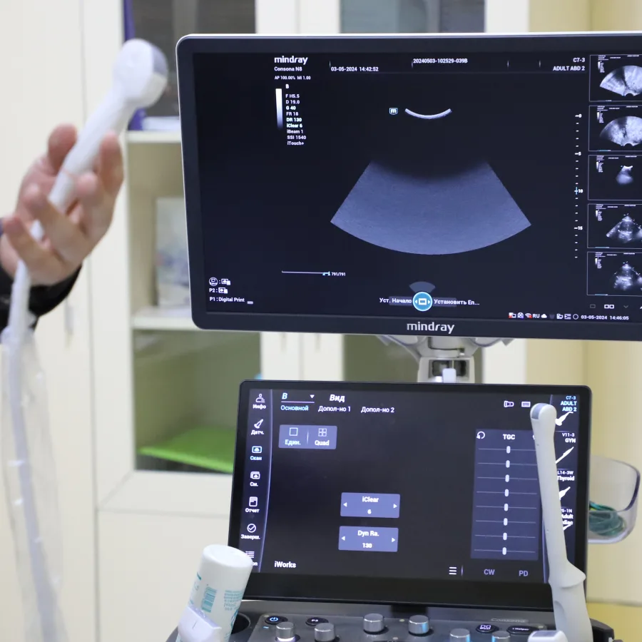Un travailleur de la santé explique le fonctionnement d’un nouvel appareil d’échographie à une équipe de l’UNOPS lors d’une visite.